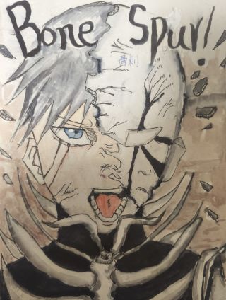 骨刺Bone Spur！