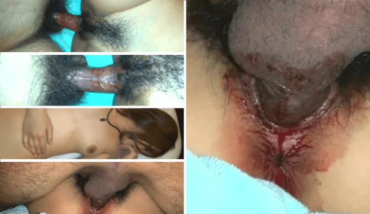 （破处）全网最真实破处大学生被大款包养第一次流了好多血